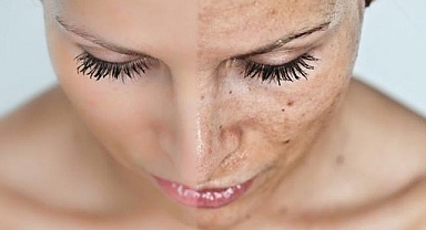 Beyazlatıcı yüz maskesi mucizesi