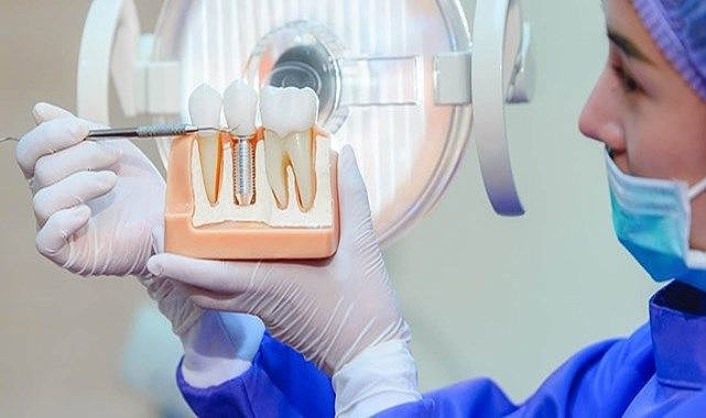 İmplant tedavisinde doğru sanılan yanlışlar