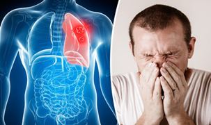 Akciğer kanseri için belirli kişilerde yıllık tarama şart