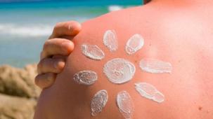 Güneş yanığına dikkat!