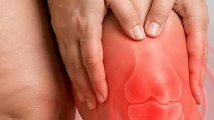 Diz biyomekaniğini bozan süreç: Lipödem