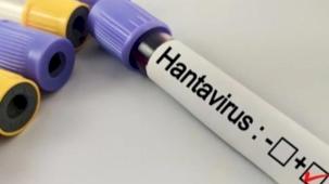 Hantavirüs salgına dönüşür mü? Kapalı alan temizliğinde büyük risk