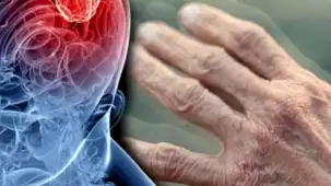 Tarım ilaçları parkinson riskini artırabilir