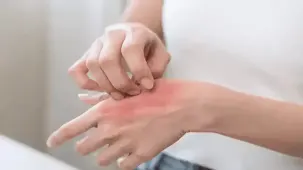 Kaşıntı cilt sorunu değil, duygusal durum